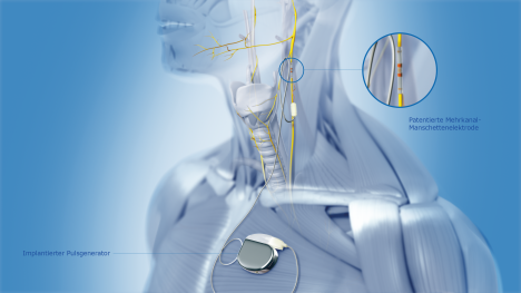Bioelectronics: Merck und B. Braun kooperieren -